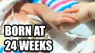 Born at 24 Weeks MicroPreemie Documentary [upl. by Noraa]