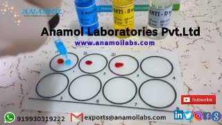 Blood Grouping Test Procedure [upl. by Alilad871]