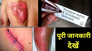 Povilab OZ Ointment Uses Or Side Effects in hindi [upl. by Zeus672]