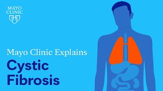 Mayo Clinic Explains Cystic Fibrosis [upl. by Sabah760]