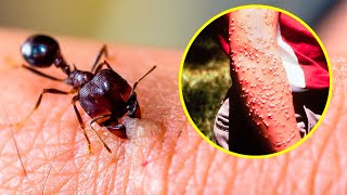 The DEADLIEST INSECTS In The World [upl. by Yokum]