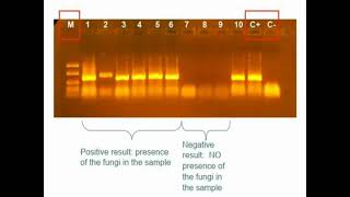 Final Product of PCR in Agarose Gel Electrophoresis [upl. by Kiki]