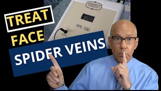 Learn How To Remove Spider Veins on the Cheeks Chin and Nose A Guide for Doctors and Nurses [upl. by Swihart]