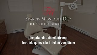 Implants dentaires étapes de lintervention par le denturologiste Francis Migneault 450 4445051 [upl. by Anile]