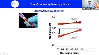 VIII Master Class  Detección de anomalías cromosómicas y qué estudios pedir [upl. by Ordnasela]