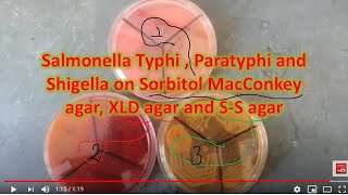 Salmonella enerica serotype Typhi amp Paratyphi growth on various media [upl. by Wallas271]