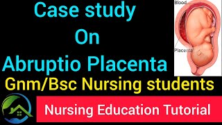 CASE STUDY ON ABRUPTIO PLACENTA for all Nursing students by NET [upl. by Polk]