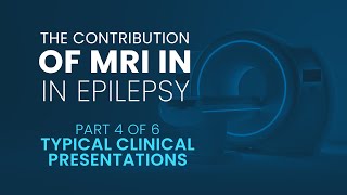 The contribution of MRI in Epilepsy  Part 4 Typical Clinical Presentations [upl. by Tiga618]