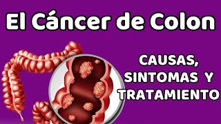 EL CÁNCER DE COLON Causas signos y síntomas diagnóstico y tratamiento [upl. by Asylla]