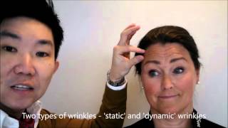 Dr Kieren Bong  Botox for StaticDynamic Wrinkles Explanation [upl. by Anerac]