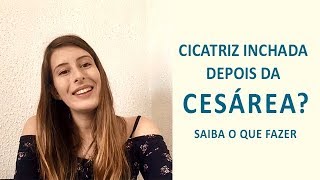 Cicatriz inchada após cesárea Saiba o que fazer [upl. by Robyn617]