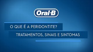 Periodontite sintomas e tratamento [upl. by Hessler]