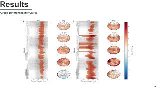 Aberrant EEG signal variability at a specific temporal scale in major depressive disorder [upl. by Enelkcaj]