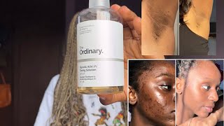 HOW TO EFFECTIVELY USE GLYCOLIC ACID TO CLEAR DARKSPOTS  TRANSFORMED SKINCARE ROUTINE [upl. by Sire160]