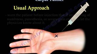 Carpal Tunnel Injection  Everything You Need To Know  Dr Nabil Ebraheim [upl. by Padget360]