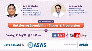 Live session with Dr Rahul Jain Stages amp progression of ankylosing spondylitis [upl. by Haliehs145]