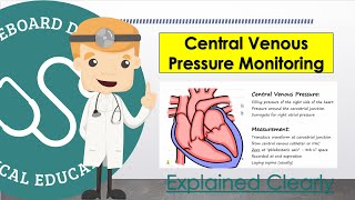 Central Venous Pressure CVP Monitoring and Measurement Basics [upl. by Ffirahs]