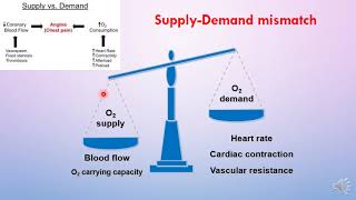 Treatment of angina [upl. by Anaihsat]