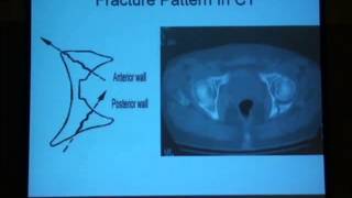 12 Radiological diagnosis of the acetabulum H Abdel Azeem [upl. by Auvil571]