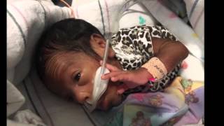 Micro preemie born at 24 weeks 5 days at 1lb 4oz [upl. by Blackstock]