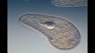 Microbiology of Eukaryotes Protozoa [upl. by Soloma]