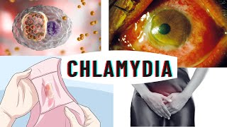 Chlamydia infection  causes symptoms complications amp diagnosis [upl. by Assillam516]