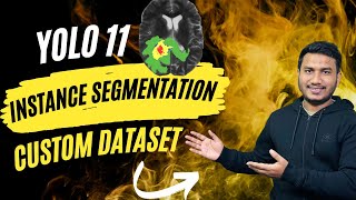 YOLO11 Instance Segmentation on Custom Dataset [upl. by Krm34]