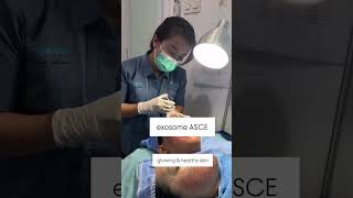 asce exosome  the best [upl. by Rramahs763]