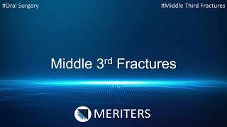 NEET MDS  INICET  Oral Surgery  Middle 3rd Fracture  MERITERS [upl. by Lobel212]