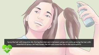 how to remove nits from hair  Lice Treatment [upl. by Yborian]