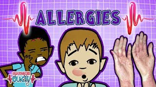 Operation Ouch  Alarming Allergies  Immune System [upl. by Yroc709]