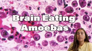 BrainEating Amoebas [upl. by Eessac]