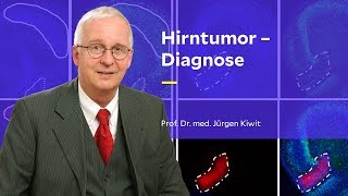 Hirntumor – Diagnose [upl. by Drawoh]