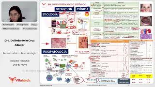 LUPUS ERITEMATOSO SISTÉMICO  REUMATOLOGÍA  VILLAMEDIC [upl. by Olnton247]