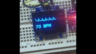 Heartpulse sensor with Arduino [upl. by Evonne]