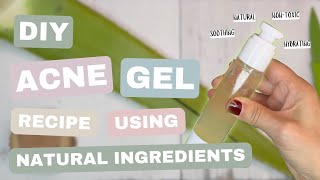 How to Make DIY Acne Gel at Home [upl. by Aubarta]