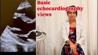 Basic echocardiography viewsechocardiography [upl. by Cynarra]