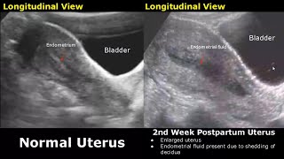 Gynecological amp Obstetric Ultrasound Normal Vs Abnormal Scan  Uterus Ovary Cervix Pregnancy USG [upl. by Atinniuq]