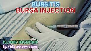 BURSITIS  BURSA INJECTION  ruralhealthcare syarhan [upl. by Cahn]