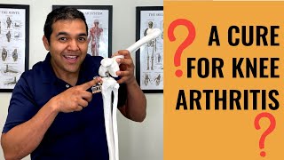 Can Knee Arthritis Be Cured What Doctors CAN’T Tell You [upl. by Jenesia]