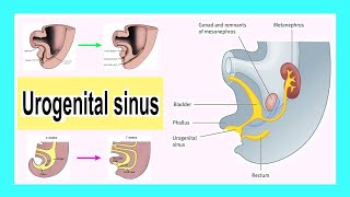 urogenital sinus [upl. by Lednahc]