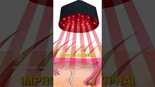 LED lights for hair Growth  Dr Sarin [upl. by Jeroma565]