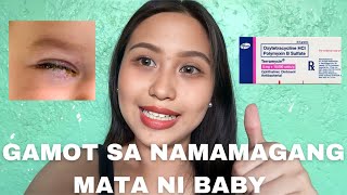 EFFECTIVE NA GAMOT SA PAMAMAGA NG MATA NI BABY [upl. by Connel]