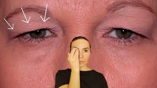 Fix droopy eyelids  How to tighten droopy eyelids [upl. by Irik]