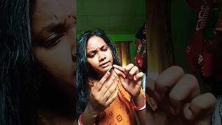 Sick hangnails 😳🥲 Full Version shorts viral [upl. by Guntar]