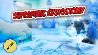 Suprapubic cystostomy  Everything Surgeries ✅😬⁉️ [upl. by Nyleuqcaj]