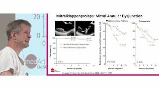 medArt 2023 Dienstag 02 Mitralklappeninsuffizienz B Kaufmann [upl. by Oralle501]