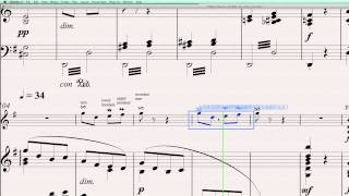 Sibelius 6 Quick Tip 4 Creating Ornaments [upl. by Nnire]