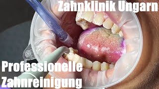 PZR Professionelle Zahnreinigung beugt Karies amp Parodontitis vor Plaque Scaling Airflow Politur [upl. by Daniala943]