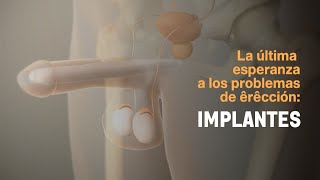 La última esperanza a los problemas de erección Implantes [upl. by Romeyn]